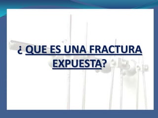 ¿ QUE ES UNA FRACTURA EXPUESTA?Se denomina fractura expuesta a toda solución de continuidad de un segmento óseo en contacto con el medio exterior, sean visibles o no los extremos fracturarios. La herida está en comunicación con el foco de fractura. 