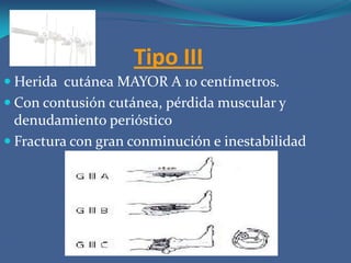 Tipo IIIA: grave pérdida ósea, muscular, lesión de un nervio o un tendón pero que conserva la cobertura del foco óseo.B: Compromiso severo de partes blandas, pérdida de tejidos, sin capacidad de cobertura del foco óseoC: Lesión arterial y nerviosa, independientemente del compromiso de partes blandas