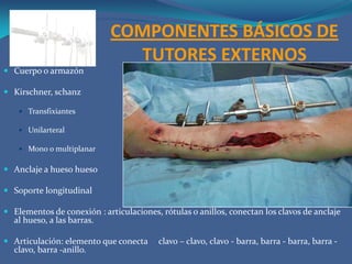 TIPOS DE TUTORES EXTERNOS