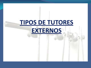 Fijador externo AOEs un sistema de simple diseño, fácil aplicación y gran versatilidad Proporciona estabilidad y adecuada asistencia a las partes blandas, neutraliza los movimientos multidireccionalesSe caracterizan por tener una articulación para cada clavo de fijación al huesoLo conforman:Clamps o rótulas ajustables que conectan los clavos a las barras.Tubos o barras de acero inoxidable o fibras de carbón.Clavos de Schanz.Clavos de Steinmann