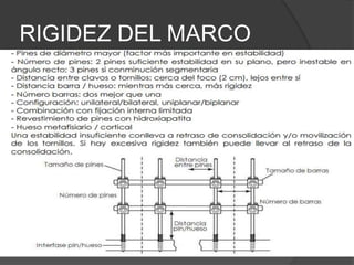 RIGIDEZ DEL MARCO
 