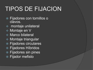 TIPOS DE FIJACION
 Fijadores con tornillos o
clavos.
 montaje unilateral
 Montaje en V
 Marco bilateral
 Montaje triangular
 Fijadores circulares
 Fijadores Híbridos
 Fijadores sin pines
 Fijador mefisto
 
