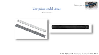 Fijadores externos
Componentes del Marco:
Barras conectoras:
Bucholz RW, Heckman JD. Fracturas en el adulto. Estados Unidos. 231-244
 