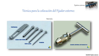 Fijadores externos
Técnica para la colocación del Fijador externo:
AO/ASIF Fijador externo
Materiales:
 