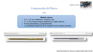 Fijadores externos
Componentes del Marco:
Clavos:
Medios clavos
• 2,3 – 3,5 mm antebrazo, muñeca o pie.
• 5 – 6 mm huesos largos diafisiarios y región pélvica.
• Punta redondeada y autoperforante.
• La estabilidad depende de la sujeción en la cortical contraria.
Bucholz RW, Heckman JD. Fracturas en el adulto. Estados Unidos. 231-244
 