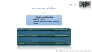 Fijadores externos
Componentes del Marco:
Clavos:
Clavos transfixiantes
• Miden 4 – 5 mm
• La rosca se encuentra en su parte
central.
Bucholz RW, Heckman JD. Fracturas en el adulto. Estados Unidos. 231-244
 