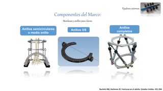 Fijadores externos
Componentes del Marco:
Mordazas y anillos para clavos:
Anillos 5/8
Anillos
completos
Anillos semicirculares
o medio anillo
Bucholz RW, Heckman JD. Fracturas en el adulto. Estados Unidos. 231-244
 