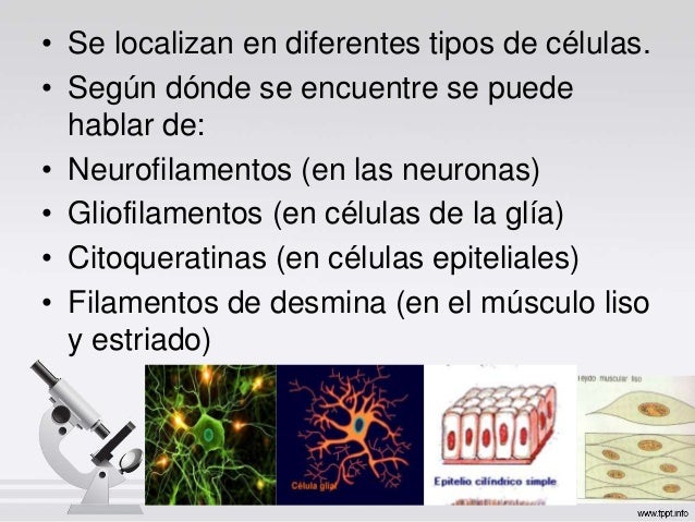Filamentos intermedios