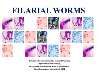 FILARIAL WORMS
Dr. R.Someshwaran, MBBS, MD., Assistant Professor,
Department of Microbiology,
Karpagam Faculty of Medical Sciences and Research,
Othakalmandapam, Coimbatore-641032
 