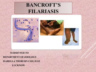 BANCROFT’S
FILARIASIS
SUBMITTED TO
DEPARTMENT OF ZOOLOGY
ISABELLA THOBURN COLLEGE
LUCKNOW
 