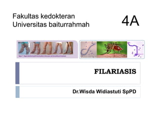 FILARIASIS
Dr.Wisda Widiastuti SpPD
Fakultas kedokteran
Universitas baiturrahmah 4A
 