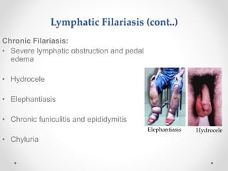 Funicularitis FILARIASIS AIIMS Rishikesh Micro Biology.pptx