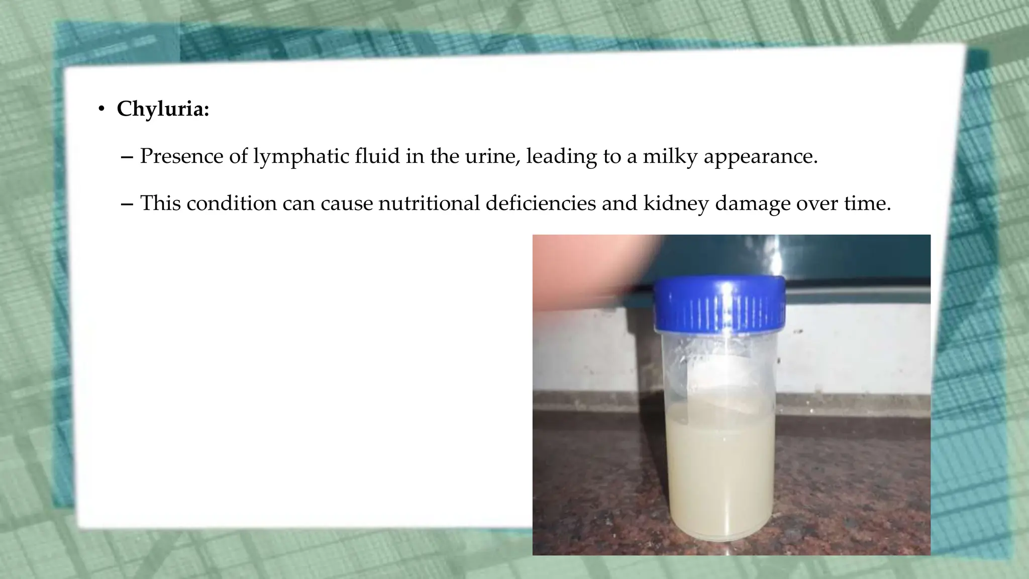 • Chyluria:
– Presence of lymphatic fluid in the urine, leading to a milky appearance.
– This condition can cause nutritional deficiencies and kidney damage over time.
