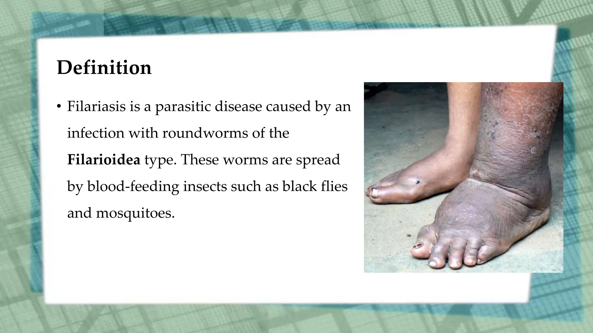 Definition
• Filariasis is a parasitic disease caused by an
infection with roundworms of the
Filarioidea type. These worms are spread
by blood-feeding insects such as black flies
and mosquitoes.