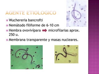  Wuchereria bancrofti
 Nemátodo filiforme de 6-10 cm
 Hembra ovovivípara microfilarias aprox.
250 u.
 Membrana transparente y masas nucleares.
 