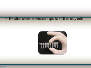 • Estudios recientes muestran que la PCR es muy útil;
 