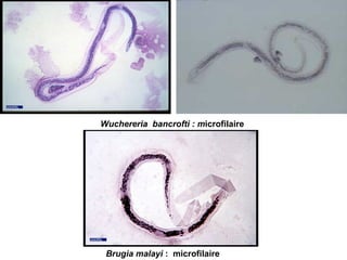 Wuchereria bancrofti : microfilaire




 Brugia malayi : microfilaire
 