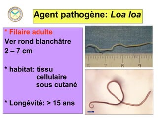 Agent pathogène: Loa loa
* Filaire adulte
Ver rond blanchâtre
2 – 7 cm

* habitat: tissu
           cellulaire
           sous cutané

* Longévité: > 15 ans
 
