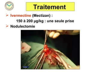 Traitement
 Ivermectine (Mectizan) :
     150 à 200 µg/kg : une seule prise
 Nodulectomie
 