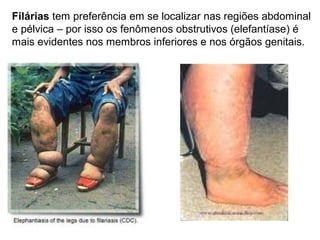 Filárias tem preferência em se localizar nas regiões abdominal
e pélvica – por isso os fenômenos obstrutivos (elefantíase) é
mais evidentes nos membros inferiores e nos órgãos genitais.
 