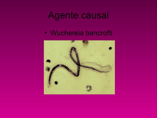 Agente causal
• Wuchereia bancrofti
 
