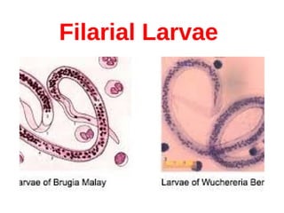 Filarial Larvae
 