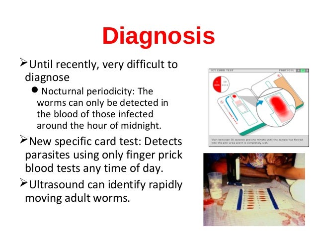 Filariasis