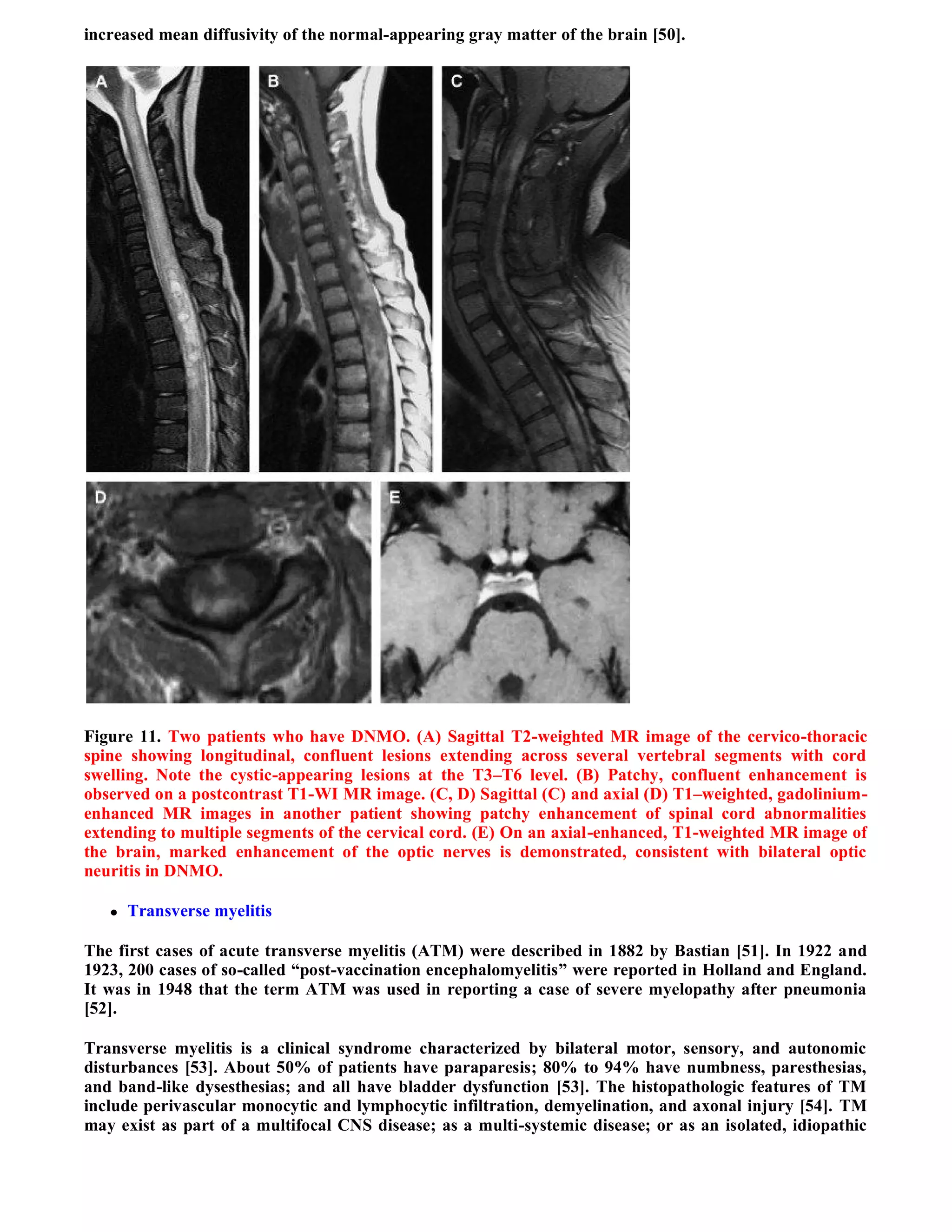 Case record...Spinal multiple sclerosis