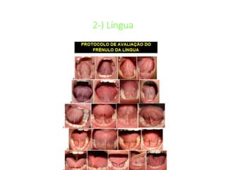 2-) Língua
 