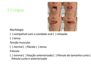 2-) Língua
Morfología
( ) compatível com a cavidade oral ( ) relaxada
( ) tensa
Tensão muscular
( ) normal ( ) flácida ( ) tensa
Frênulo
( ) normal ( ) fixação anteriorizada ( ) frênulo de tamanho curto (
frênulo curto e anteriorizado
 