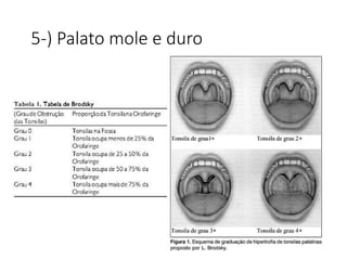 5-) Palato mole e duro
 