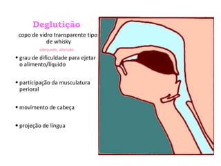 Deglutição
copo de vidro transparente tipo
de whisky
adequado, alterado
 grau de dificuldade para ejetar
o alimento/líquido
 participação da musculatura
perioral
 movimento de cabeça
 projeção de língua
 