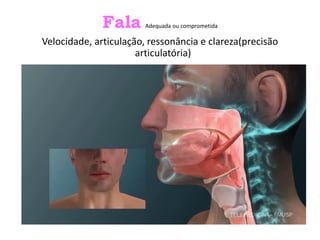Fala Adequada ou comprometida
Velocidade, articulação, ressonância e clareza(precisão
articulatória)
 