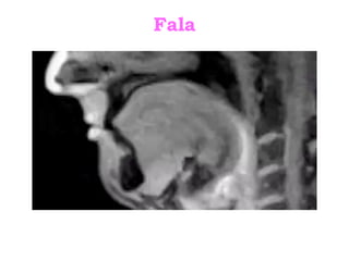 Fala
 