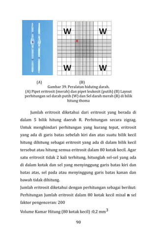 90
(A) (B)
Gambar 39. Peralatan hidutng darah.
(A) Pipet eritrosit (merah) dan pipet leukosit (putih) (B) Layout
perhitungan sel darah putih (W) dan Sel darah merah (R) di bilik
hitung thoma
Jumlah eritrosit diketahui dari eritrosit yang berada di
dalam 5 bilik hitung daerah R. Perhitungan secara zigzag.
Untuk menghindari perhitungan yang kurang tepat, eritrosit
yang ada di garis batas sebelah kiri dan atas suatu bilik kecil
hitung dihitung sebagai eritrosit yang ada di dalam bilik kecil
tersebut atau hitung semua eritrosit dalam 80 kotak kecil. Agar
satu eritrosit tidak 2 kali terhitung, hitunglah sel-sel yang ada
di dalam kotak dan sel yang menyinggung garis batas kiri dan
batas atas, sel pada atau menyinggung garis batas kanan dan
bawah tidak dihitung.
Jumlah eritrosit diketahui dengan perhitungan sebagai berikut:
Perhitungan Jumlah eritrosit dalam 80 kotak kecil misal n sel
faktor pengenceran: 200
Volume Kamar Hitung (80 kotak kecil) :0,2 mm3
 