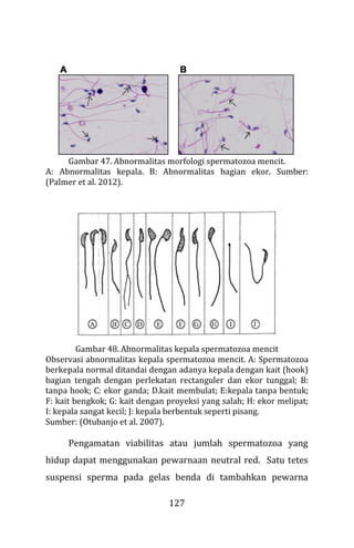 127
Gambar 47. Abnormalitas morfologi spermatozoa mencit.
A: Abnormalitas kepala. B: Abnormalitas bagian ekor. Sumber:
(Palmer et al. 2012).
Gambar 48. Abnormalitas kepala spermatozoa mencit
Observasi abnormalitas kepala spermatozoa mencit. A: Spermatozoa
berkepala normal ditandai dengan adanya kepala dengan kait (hook)
bagian tengah dengan perlekatan rectanguler dan ekor tunggal; B:
tanpa hook; C: ekor ganda; D.kait membulat; E:kepala tanpa bentuk;
F: kait bengkok; G: kait dengan proyeksi yang salah; H: ekor melipat;
I: kepala sangat kecil; J: kepala berbentuk seperti pisang.
Sumber: (Otubanjo et al. 2007).
Pengamatan viabilitas atau jumlah spermatozoa yang
hidup dapat menggunakan pewarnaan neutral red. Satu tetes
suspensi sperma pada gelas benda di tambahkan pewarna
 