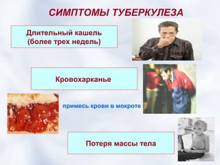 СИМПТОМЫ ТУБЕРКУЛЕЗА
Длительный кашель
(более трех недель)




       Кровохарканье


         примесь крови в мокроте




               Потеря массы тела
 