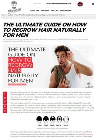 Home » Hair loss » Tips » The Ultimate Guide on How to Regrow Hair Naturally for Men
FACIAL HAIR GROOMING HAIR LOSS MEN’S FASHION
ULTRAX LABS ULTRAX LABS HAIR VIGOR MASK REVIEW
 