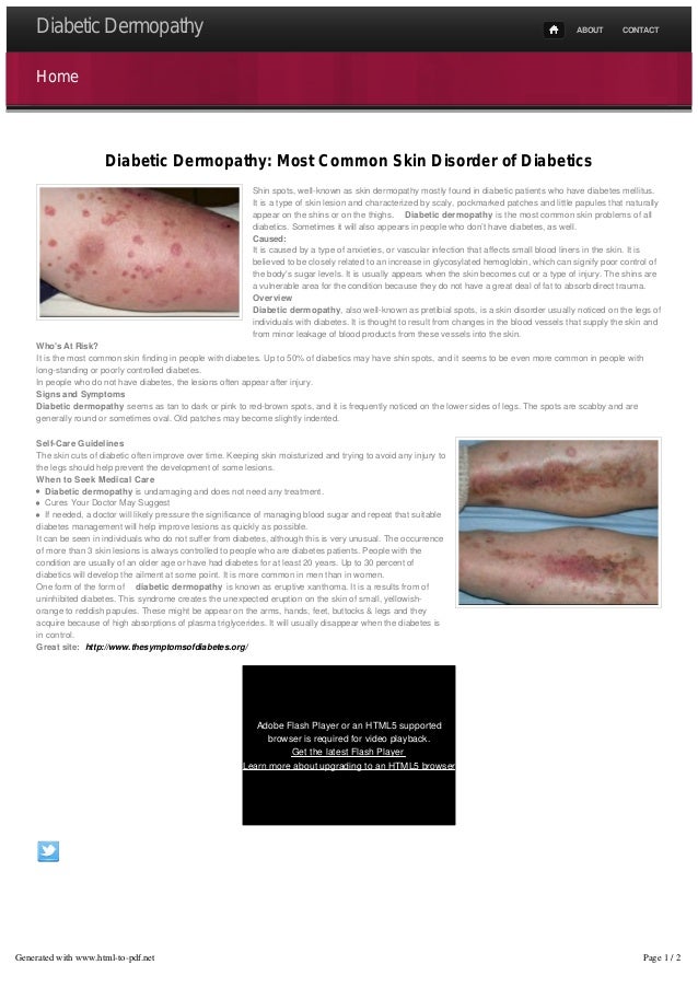 Diabetic Dermopathy Most Common Skin Disorder Of Diabetics Diabetic Dermopathy Most Common Skin Disorder Of Diabetics