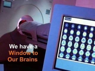 We have a  Window to Our Brains  
