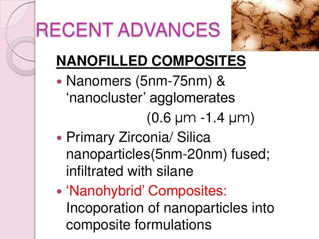 Fillers in composite resins