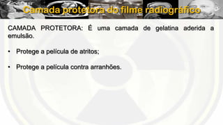 Camada protetora do filme radiográfico
CAMADA PROTETORA: É uma camada de gelatina aderida a
emulsão.
• Protege a película de atritos;
• Protege a película contra arranhões.

 