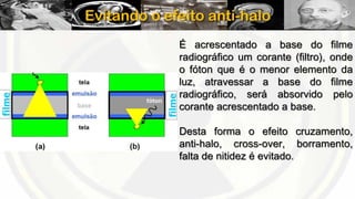 Evitando o efeito anti-halo
É acrescentado a base do filme
radiográfico um corante (filtro), onde
o fóton que é o menor elemento da
luz, atravessar a base do filme
radiográfico, será absorvido pelo
corante acrescentado a base.
Desta forma o efeito cruzamento,
anti-halo, cross-over, borramento,
falta de nitidez é evitado.

 