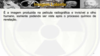 Imagem Latente
É a imagem produzida na película radiográfica e invisível a olho
humano, somente podendo ser vista após o processo químico de
revelação.

20

 