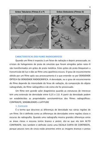 Grãos Tabulares (Filmes E e F) Grãos Globulares (Filmes D)
CARACTERÍSTICAS DOS FILMES RADIOGRÁFICOS
Quando um ﬁlme é exposto à um feixe de radiação e depois processado, os
cristais de halogenetos de prata de emulsão que foram atingidos pelos raios-X
são transformados em grãos de prata metálica. Estes grãos de prata bloqueiam a
transmissão de luz e dão ao ﬁlme uma aparência escura. O grau de escurecimento
obtido por um ﬁlme após seu processamento é o que entende-se por DENSIDADE
ÓPTICA OU DENSIDADE RADIOGRÁFICA. A densidade, ou o grau de escurecimento
do ﬁlme depende da intensidade do feixe de radiação, da composição do objeto
radiografado, do ﬁlme radiográﬁco e de como ele foi processado.
Um ﬁlme tem grande valor diagnóstico quando as estruturas de interesse
tem uma extensão de densidade entre 0,25 e 2,0. À partir da densidade podem
ser estabelecidas as propriedades sensitométricas dos ﬁlmes radiográﬁcos:
CONTRASTE, SENSIBILIDADE e LATITUDE
1. Contraste
É o termo que descreve as diferenças de densidade nas várias regiões de
um ﬁlme. Ele é deﬁnido como as diferenças de densidades entre regiões claras e
escuras da radiograﬁa. Quando uma radiograﬁa mostra grandes diferenças entre
as áreas claras e escuras (entre branco e preto), diz-se que ela tem ALTO
CONTRASTE. Isto também é deﬁnido como uma ESCALA CURTA DE CONTRASTE,
porque poucos tons de cinza estão presentes entre as imagens brancas e pretas
6
 