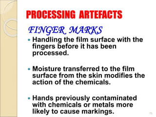 PROCESSING ARTEFACTS
FINGER MARKS
 Handling the film surface with the
fingers before it has been
processed.
 Moisture transferred to the film
surface from the skin modifies the
action of the chemicals.
 Hands previously contaminated
with chemicals or metals more
likely to cause markings. 73
 