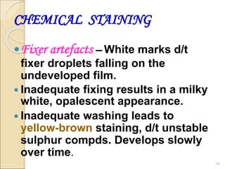 CHEMICAL STAINING
Fixer artefacts – White marks d/t
fixer droplets falling on the
undeveloped film.
 Inadequate fixing results in a milky
white, opalescent appearance.
 Inadequate washing leads to
yellow-brown staining, d/t unstable
sulphur compds. Develops slowly
over time.
75
 