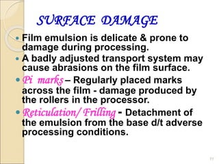 SURFACE DAMAGE
 Film emulsion is delicate & prone to
damage during processing.
 A badly adjusted transport system may
cause abrasions on the film surface.
Pi marks – Regularly placed marks
across the film - damage produced by
the rollers in the processor.
Reticulation/ Frilling - Detachment of
the emulsion from the base d/t adverse
processing conditions.
77
 