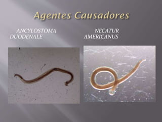 ANCYLOSTOMA
DUODENALE
NECATUR
AMERICANUS
 