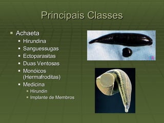Principais Classes Achaeta Hirundina Sanguessugas Ectoparasitas Duas Ventosas Monóicos (Hermafroditas) Medicina Hirundin Implante de Membros 
